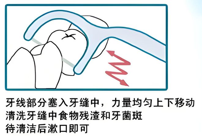 的卫生习惯--小鹿妈妈牙线凯时尊龙人生就是博年夜饭后